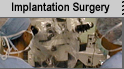 ImplantationSurgery