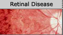Retinal Disease